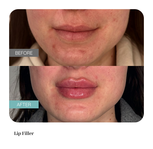 Before and after result